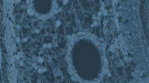 Global content strategy and operating model