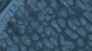 Resource planning to deliver future pipeline demand